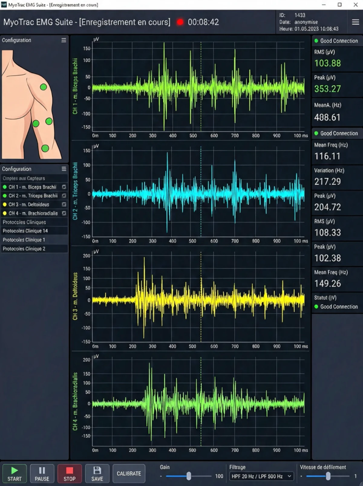 EMG control platform recording four muscle channels