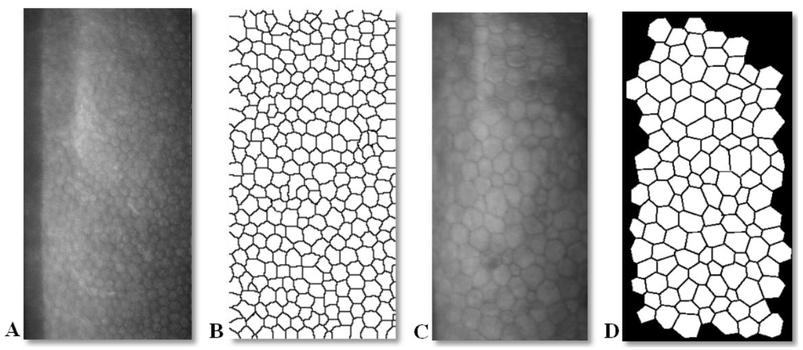 Original corneal endothelial images and their segmented cell boundaries